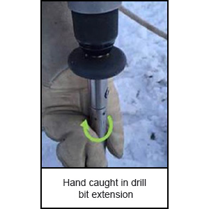 Hand caught in drill bit extension