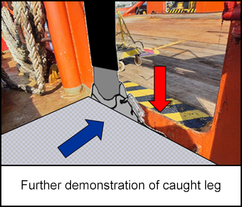 1214-s3.png Further demonstration of caught leg
