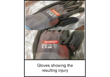 Gloves showing the resulting injury