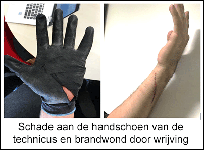 Schade aan de handschoen van de technicus en brandwond door wrijving op de onderarm